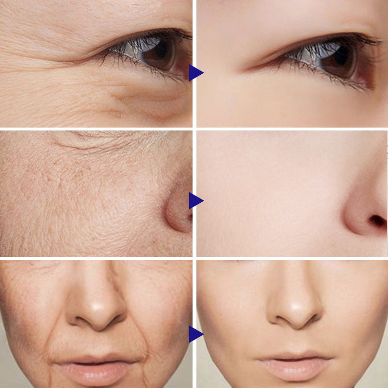 Web Based Vitamin C Serum Facial Serum Amazon