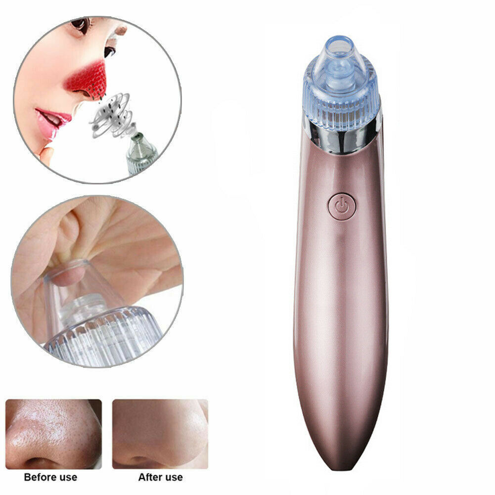 Web Based Blackhead Vacuum Pore Cleaner Acne Pimple Remover Strong Suction Tool Electric Blackhead Remover Pore Vacuum Suction Diamond Dermabrasion Face Cleaner