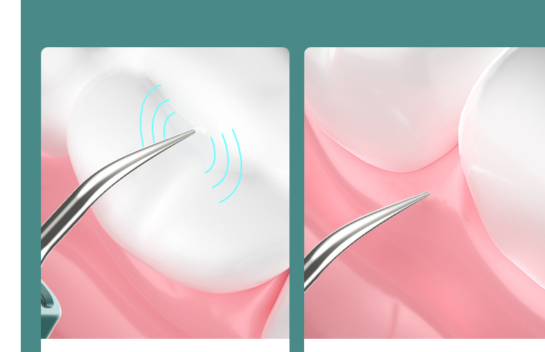 Web Based New High-definition Visual Dental Cleaner